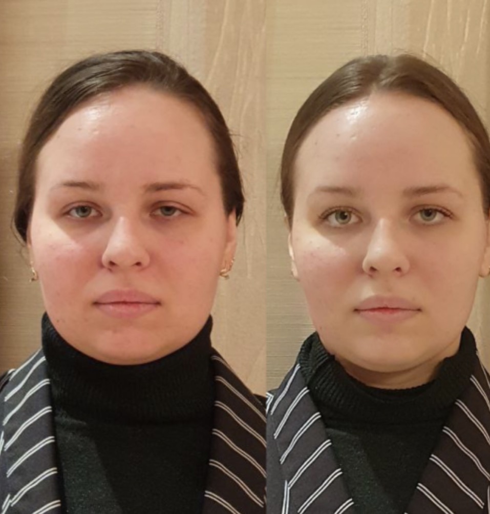 Кейс 03 — до и после системной практики